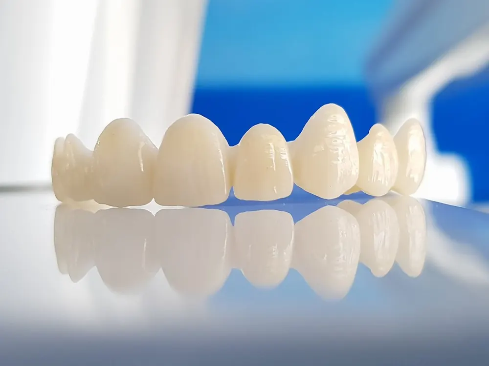 Cầu răng toàn sứ màu trắng sáng bóng được đặt trên mặt kính phản chiếu